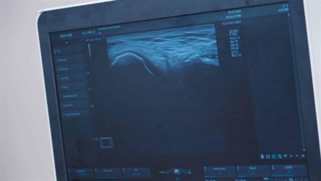 Ultrasound scan image on the clinic's ultrasound machine